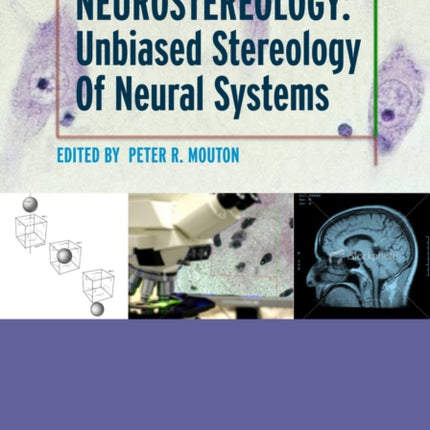 Neurostereology