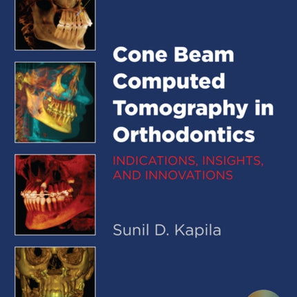 Cone Beam Computed Tomography in Orthodontics: Indications, Insights, and Innovations