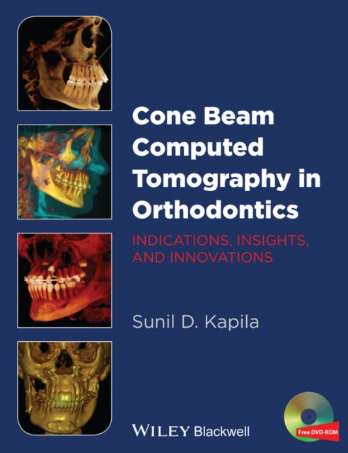 Cone Beam Computed Tomography in Orthodontics: Indications, Insights, and Innovations