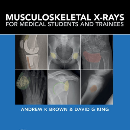 Musculoskeletal X-Rays for Medical Students and Trainees