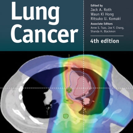 Lung Cancer