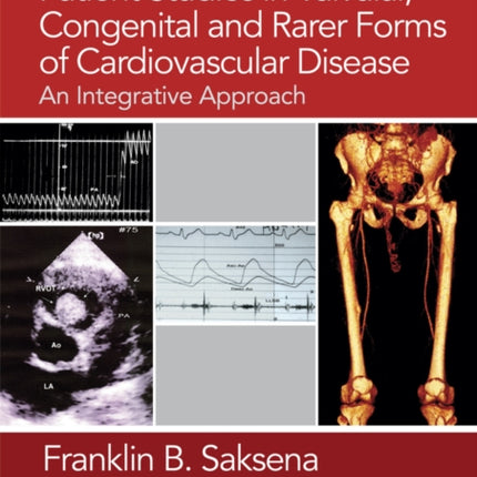 Patient Studies in Valvular, Congenital, and Rarer Forms of Cardiovascular Disease: An Integrative Approach