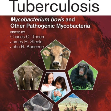 Zoonotic Tuberculosis: Mycobacterium bovis and Other Pathogenic Mycobacteria