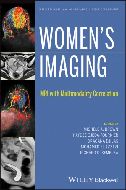 Women's Imaging: MRI with Multimodality Correlation