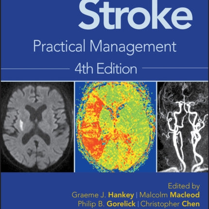 Warlow's Stroke: Practical Management