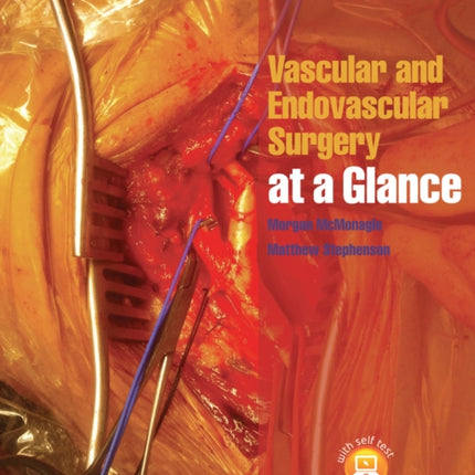 Vascular and Endovascular Surgery at a Glance