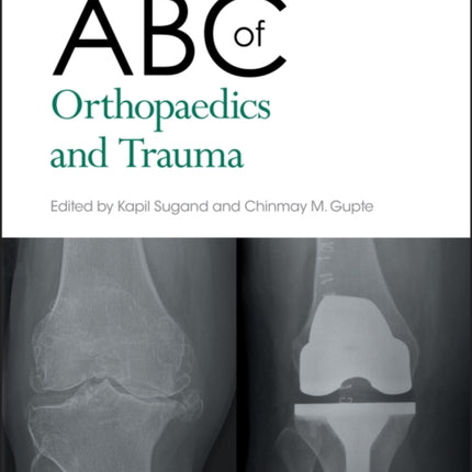 ABC of Orthopaedics and Trauma