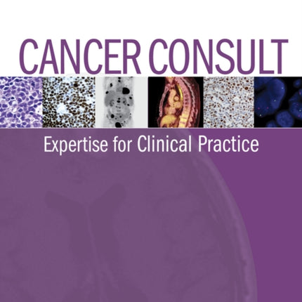 Cancer Consult: Expertise for Clinical Practice