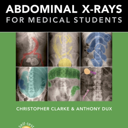 Abdominal X-rays for Medical Students