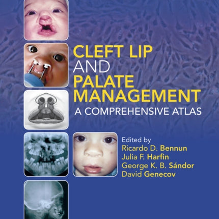 Cleft Lip and Palate Management: A Comprehensive Atlas