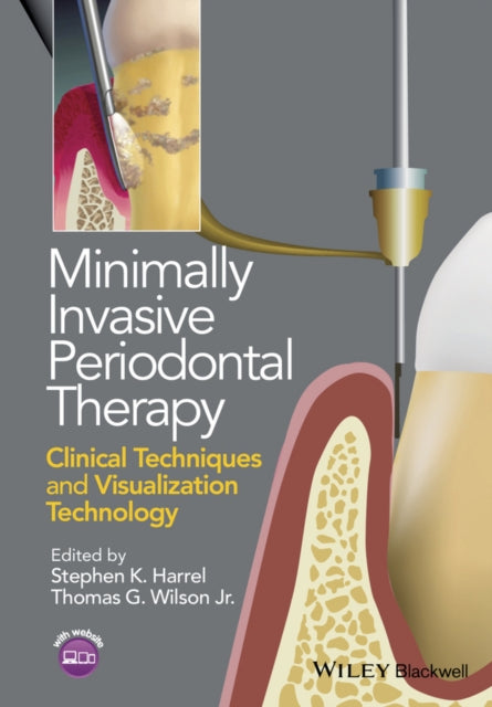 Minimally Invasive Periodontal Therapy: Clinical Techniques and Visualization Technology