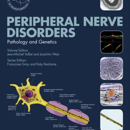 Peripheral Nerve Disorders: Pathology and Genetics