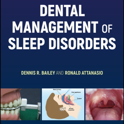 Dental Management of Sleep Disorders