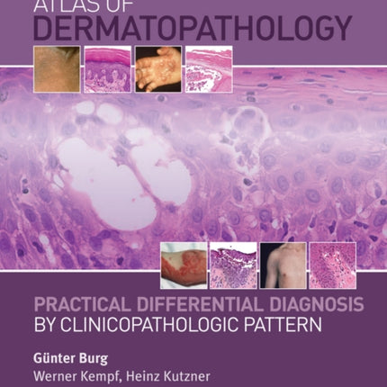 Atlas of Dermatopathology