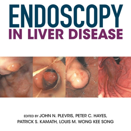 Endoscopy in Liver Disease