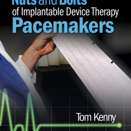 The Nuts and Bolts of Implantable Device Therapy