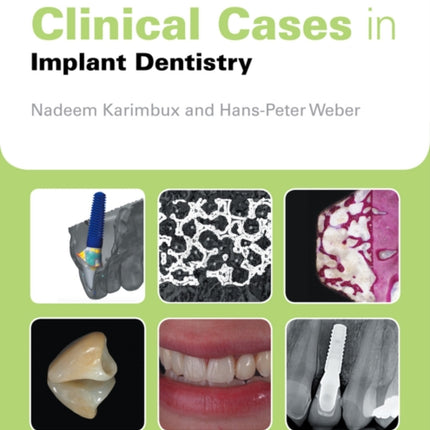 Clinical Cases in Implant Dentistry