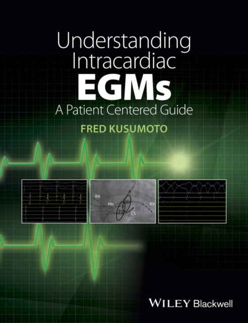 Understanding Intracardiac EGMs: A Patient Centered Guide