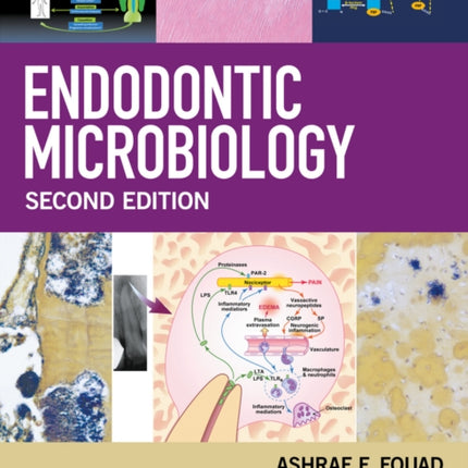 Endodontic Microbiology