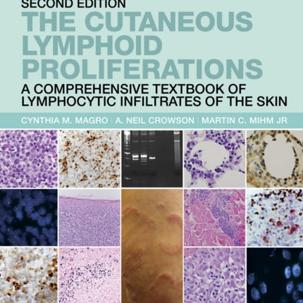 The Cutaneous Lymphoid Proliferations: A Comprehensive Textbook of Lymphocytic Infiltrates of the Skin