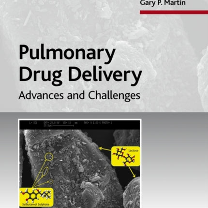 Pulmonary Drug Delivery: Advances and Challenges