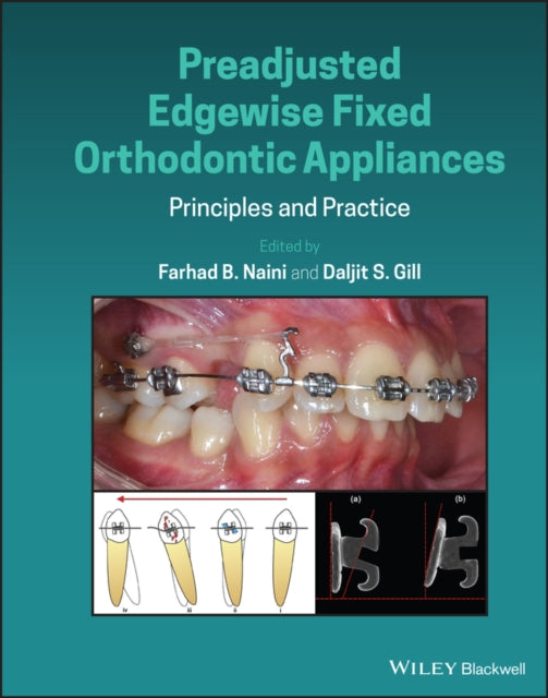 Preadjusted Edgewise Fixed Orthodontic Appliances: Principles and Practice