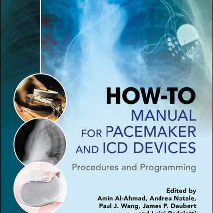 How-to Manual for Pacemaker and ICD Devices: Procedures and Programming