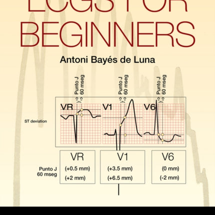 ECGs for Beginners