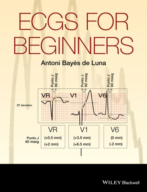 ECGs for Beginners