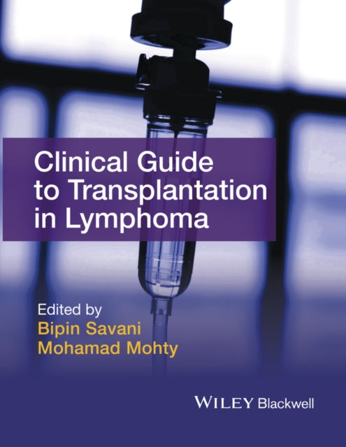 Clinical Guide to Transplantation in Lymphoma