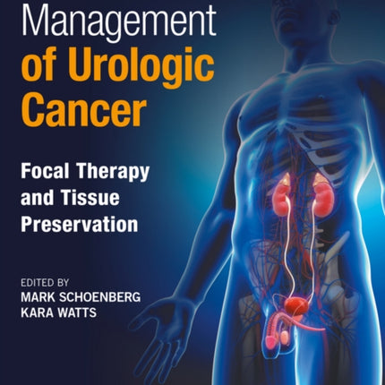 Management of Urologic Cancer: Focal Therapy and Tissue Preservation