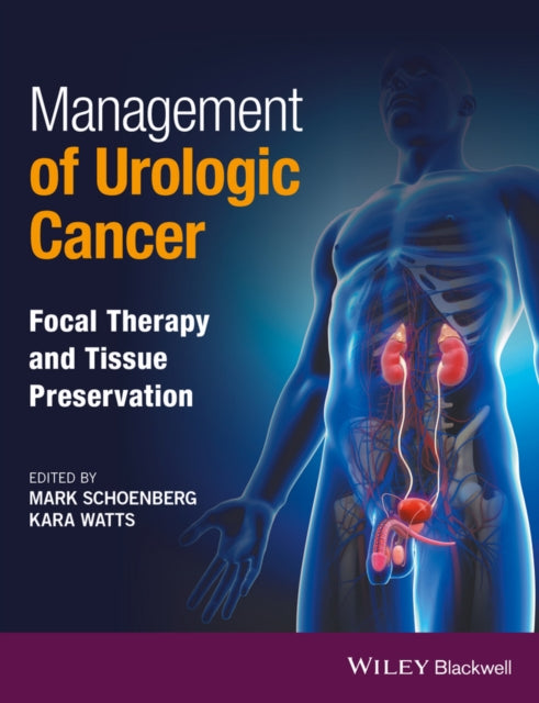 Management of Urologic Cancer: Focal Therapy and Tissue Preservation