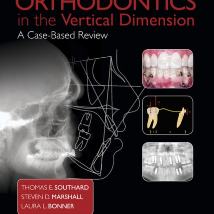 Orthodontics in the Vertical Dimension