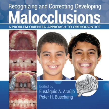 Recognizing and Correcting Developing Malocclusions: A Problem-Oriented Approach to Orthodontics