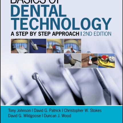 Basics of Dental Technology: A Step by Step Approach