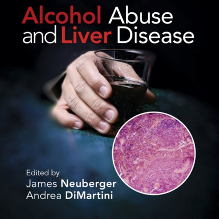 Alcohol Abuse and Liver Disease