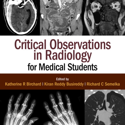 Critical Observations in Radiology for Medical Students