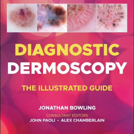 Diagnostic Dermoscopy: The Illustrated Guide