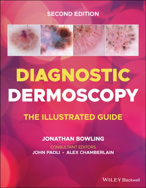 Diagnostic Dermoscopy: The Illustrated Guide