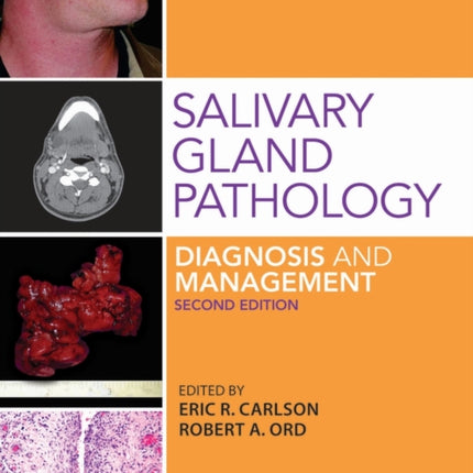 Salivary Gland Pathology