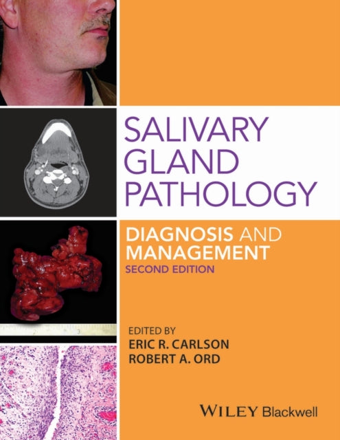 Salivary Gland Pathology