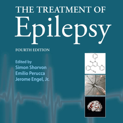 The Treatment of Epilepsy