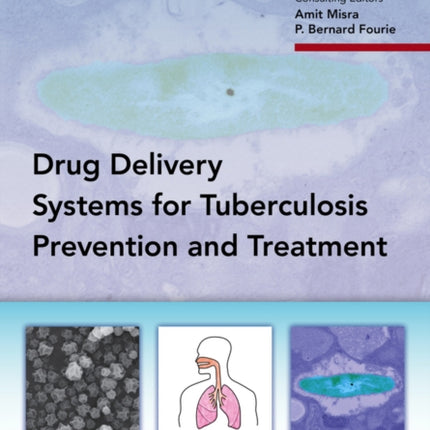 Delivery Systems for Tuberculosis Prevention and Treatment