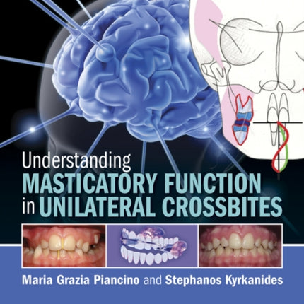 Understanding Masticatory Function in Unilateral