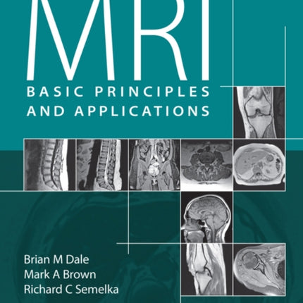 MRI: Basic Principles and Applications