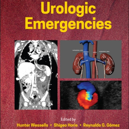 A Clinical Guide to Urologic Emergencies