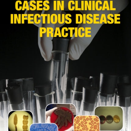 Cases in Clinical Infectious Disease Practice