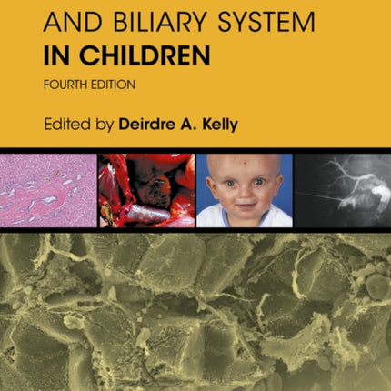 Diseases of the Liver and Biliary System in Children