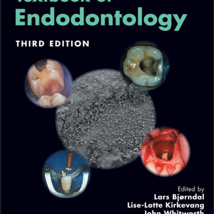 Textbook of Endodontology