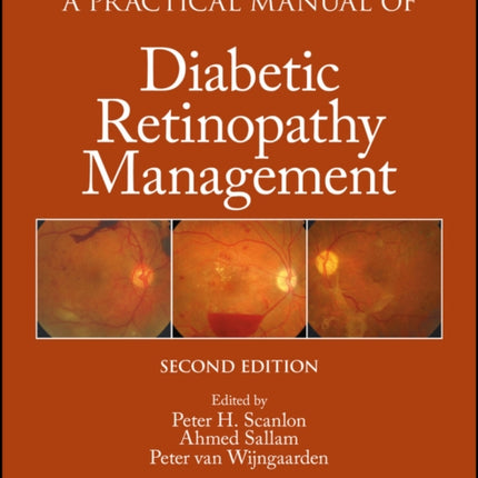 A Practical Manual of Diabetic Retinopathy Management